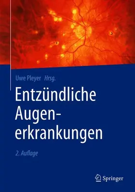 Pleyer |  Entzündliche Augenerkrankungen | Buch |  Sack Fachmedien