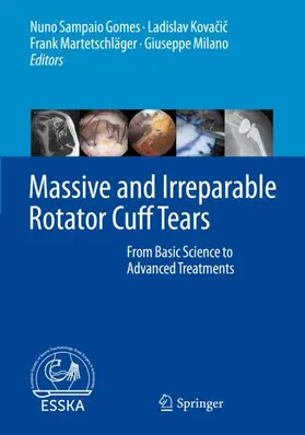 Sampaio Gomes / Milano / Kovacic | Massive and Irreparable Rotator Cuff Tears | Buch | 978-3-662-61161-6 | sack.de