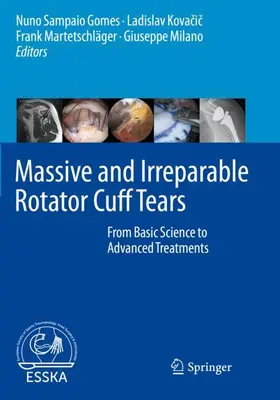 Sampaio Gomes / Milano / Kovacic |  Massive and Irreparable Rotator Cuff Tears | Buch |  Sack Fachmedien