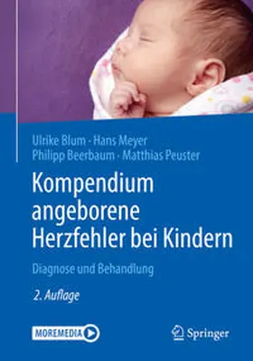 Blum / Meyer / Beerbaum |  Kompendium angeborene Herzfehler bei Kindern | eBook | Sack Fachmedien