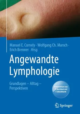 Cornely / Brenner / Marsch |  Angewandte Lymphologie | Buch |  Sack Fachmedien