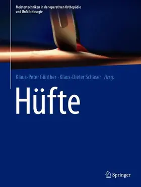 Günther / Schaser |  Hüfte | Buch |  Sack Fachmedien