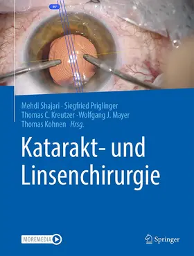 Shajari / Priglinger / Kohnen |  Katarakt- und Linsenchirurgie | Buch |  Sack Fachmedien