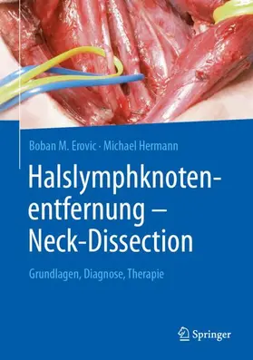 Hermann / Erovic |  Halslymphknotenentfernung - Neck-Dissection | Buch |  Sack Fachmedien