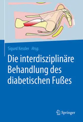 Kessler | Die interdisziplinäre Behandlung des diabetischen Fußes | E-Book | sack.de