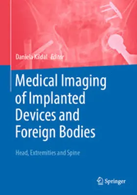 Kildal |  Medical Imaging of Implanted Devices and Foreign Bodies | eBook | Sack Fachmedien