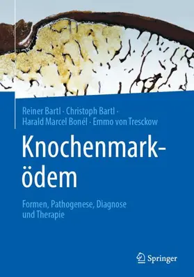 Bartl / von Tresckow / Bonél |  Knochenmarködem | Buch |  Sack Fachmedien