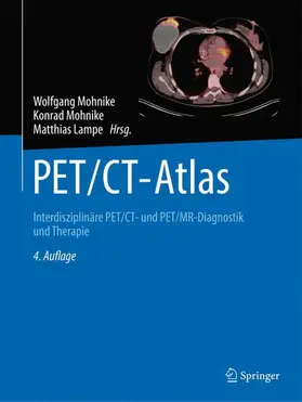 Mohnike / Lampe | PET/CT-Atlas | Buch | 978-3-662-67191-7 | sack.de