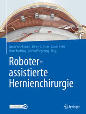 Kudsi / Dietz / Beldi | Roboterassistierte Hernienchirurgie | E-Book | sack.de