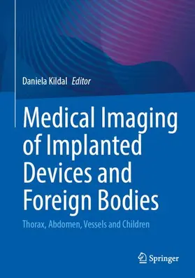 Kildal |  Medical Imaging of Implanted Devices and Foreign Bodies | Buch |  Sack Fachmedien