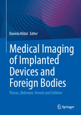 Kildal |  Medical Imaging of Implanted Devices and Foreign Bodies | eBook | Sack Fachmedien