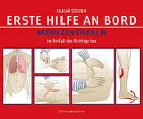 Steffen |  Erste Hilfe an Bord - Medizintafeln | Buch |  Sack Fachmedien