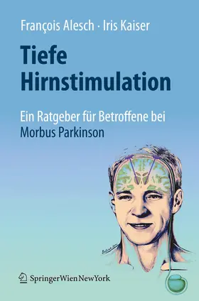Kaiser / Alesch |  Tiefe Hirnstimulation: Ein Ratgeber für Betroffene bei Morbus Parkinson | Buch |  Sack Fachmedien
