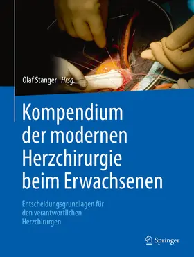 Stanger |  Kompendium der modernen Herzchirurgie beim Erwachsenen | eBook | Sack Fachmedien