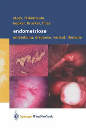 Steck / Felberbaum / Küpker | Endometriose | E-Book | sack.de