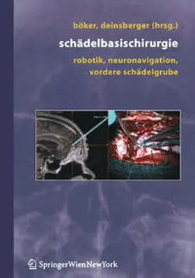 Böker / Deinsberger | Schädelbasischirurgie | E-Book | sack.de