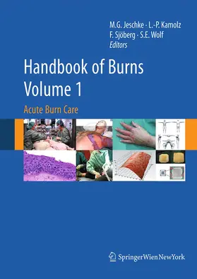 Jeschke / Wolf / Kamolz |  Handbook of Burns Volume 1 | Buch |  Sack Fachmedien