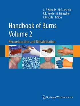 Kamolz / Jeschke / Brychta |  Handbook of Burns Volume 2 | Buch |  Sack Fachmedien