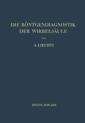 Liechti |  Die Röntgendiagnostik der Wirbelsäule und ihre Grundlagen | eBook | Sack Fachmedien