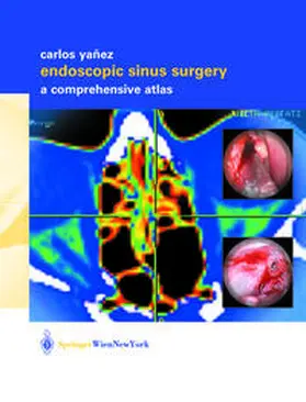 Yañez | Endoscopic Sinus Surgery | E-Book | sack.de