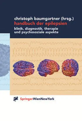 Baumgartner |  Handbuch der Epilepsien | eBook | Sack Fachmedien