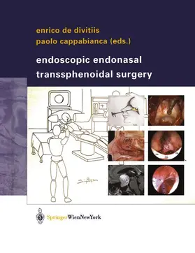 Divitiis / Cappabianca |  Endoscopic Endonasal Transsphenoidal Surgery | Buch |  Sack Fachmedien