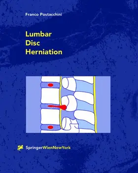 Postacchini | Lumbar Disc Herniation | Buch | 978-3-7091-7322-0 | sack.de