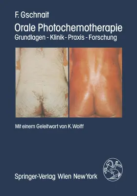 Gschnait |  Orale Photochemotherapie | Buch |  Sack Fachmedien