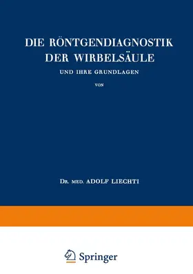 Liechti |  Die Röntgendiagnostik der Wirbelsäule und Ihre Grundlagen | Buch |  Sack Fachmedien