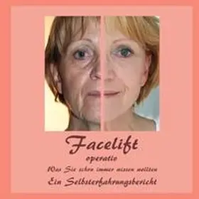 Siegmund / Fischer |  Facelift operativ | Buch |  Sack Fachmedien