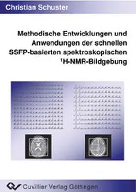 Schuster |  Methodische Entwicklungen und Anwendungen derschnellen SSFP-basierten spektroskopischen 1H-NMR-Bildgebung | eBook | Sack Fachmedien