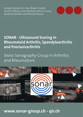 Tamborrini / Ziswiler / Zufferey |  SONAR - Ultrasound Scoring in Rheumatoid Arthritis, Spondyloarthritis and Psoriasisarthritis | Buch |  Sack Fachmedien