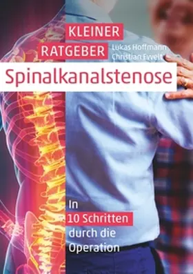 Hoffmann |  Kleiner Ratgeber Spinalkanalstenose | Buch |  Sack Fachmedien