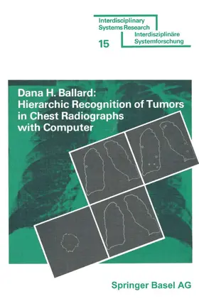 BALLARD | Hierarchic Recognition of Tumors in Chest Radiographs with Computer | Buch | 978-3-7643-0800-1 | www2.sack.de