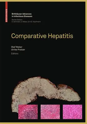 Protzer / Weber |  Comparative Hepatitis | Buch |  Sack Fachmedien