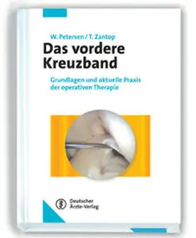 Petersen / Zantop |  Das vordere Kreuzband | Buch |  Sack Fachmedien