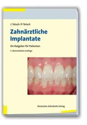 Tetsch |  Zahnärztliche Implantate | Buch |  Sack Fachmedien