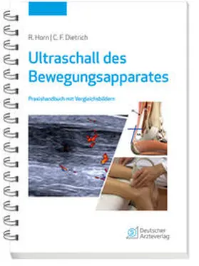 Horn / Dietrich |  Ultraschall des Bewegungsapparates | Buch |  Sack Fachmedien