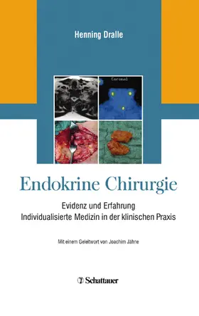 Dralle |  Endokrine Chirurgie | Buch |  Sack Fachmedien