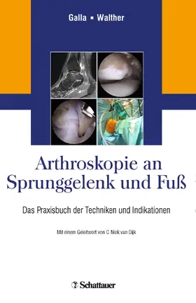 Galla / Walther | Arthroskopie an Sprunggelenk und Fuß | Buch | 978-3-7945-2967-4 | sack.de