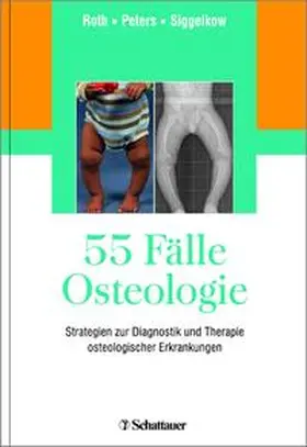 Roth / Peters / Siggelkow |  55 Fälle Osteologie | Buch |  Sack Fachmedien