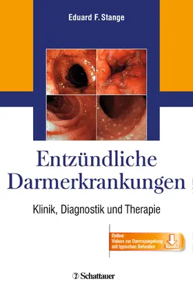 Stange |  Entzündliche Darmerkrankungen | eBook | Sack Fachmedien