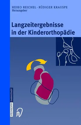 Krauspe / Reichel | Langzeitergebnisse in der Kinderorthopädie | Buch | 978-3-7985-1369-3 | sack.de