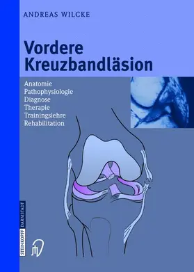 Wilcke |  Vordere Kreuzbandläsion | Buch |  Sack Fachmedien