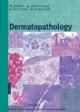 Kempf / Hantschke / Kutzner |  Dermatopathology | eBook | Sack Fachmedien