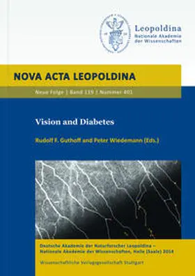 Guthoff / Wiedemann |  Vision and Diabetes | Buch |  Sack Fachmedien