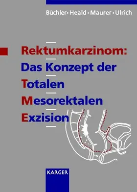 Büchler / Heald / Maurer |  Rektumkarzinom: Das Konzept der totalen mesorektalen Exzision | Buch |  Sack Fachmedien