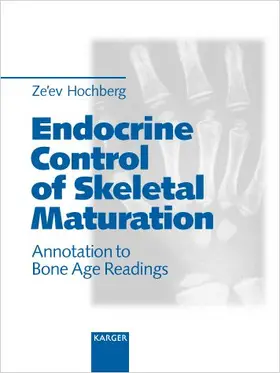 Hochberg | Endocrine Control of Skeletal Maturation | Buch | 978-3-8055-7313-9 | sack.de