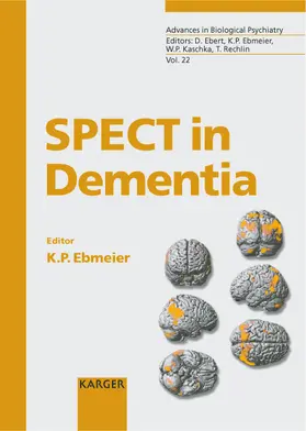 Ebmeier |  SPECT in Dementia | Buch |  Sack Fachmedien