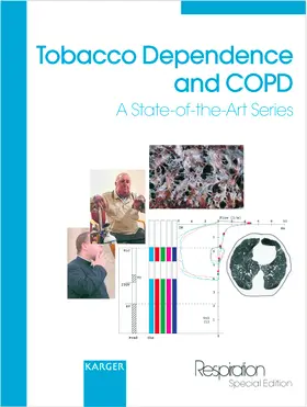 Tobacco Dependence and COPD | Buch | 978-3-8055-7653-6 | sack.de
